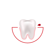 How often do you experience bleeding while brushing or flossing?